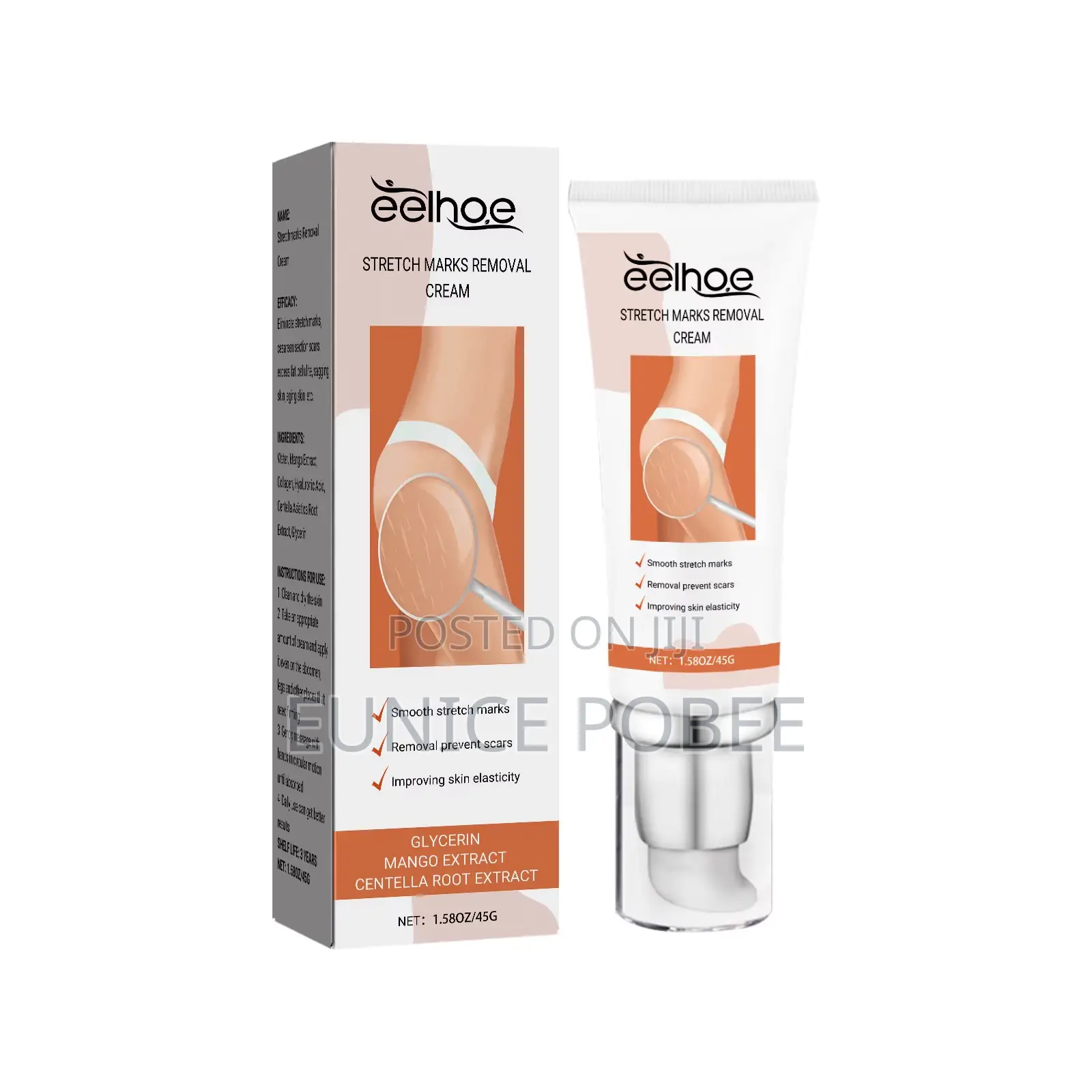 Stretch Mark Removal