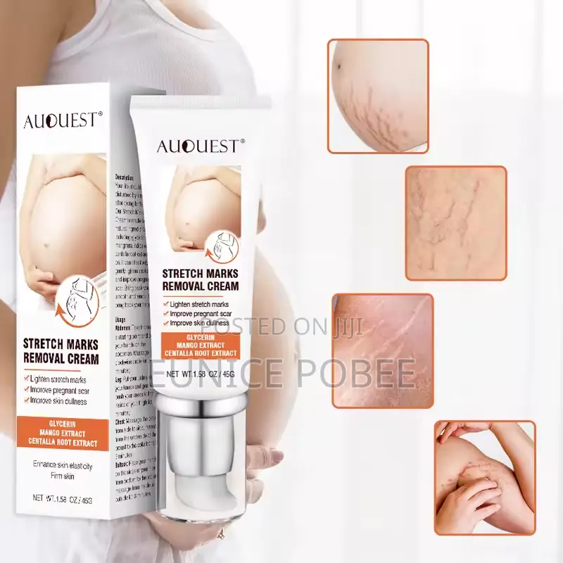 Stretch Mark Removal