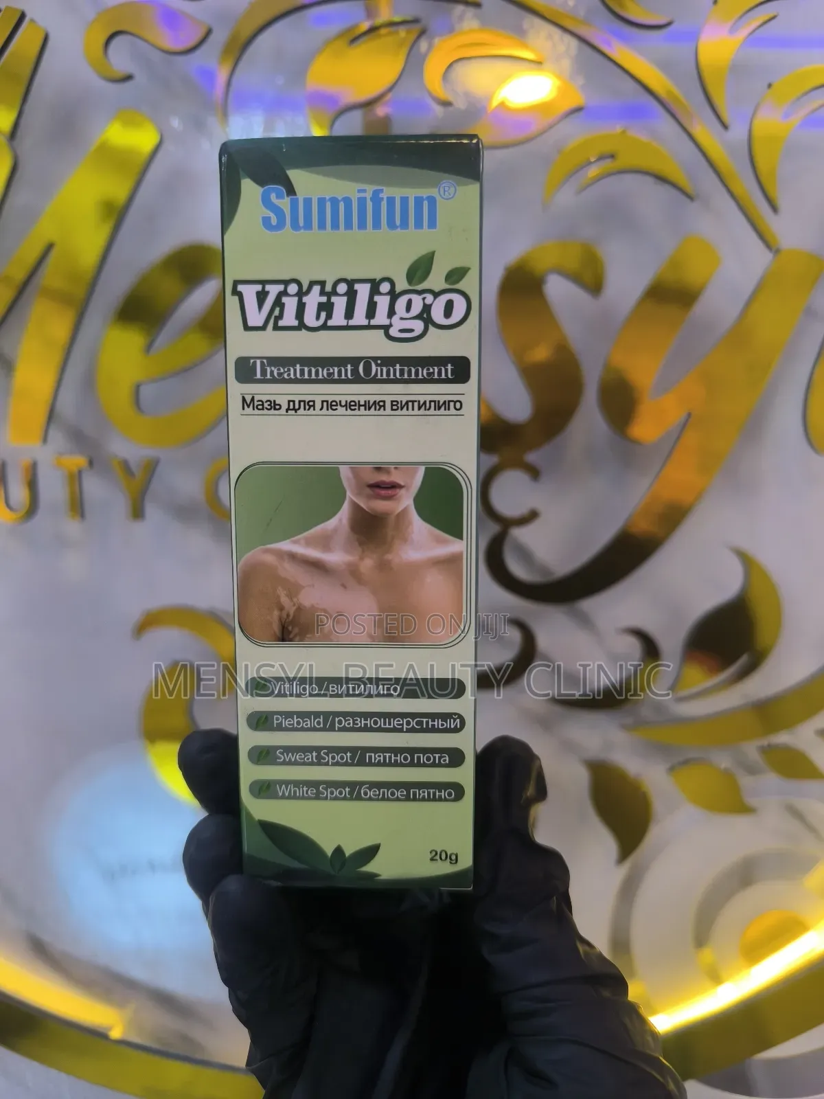 Vitiligo Cream Reduces White Spots on Skin
