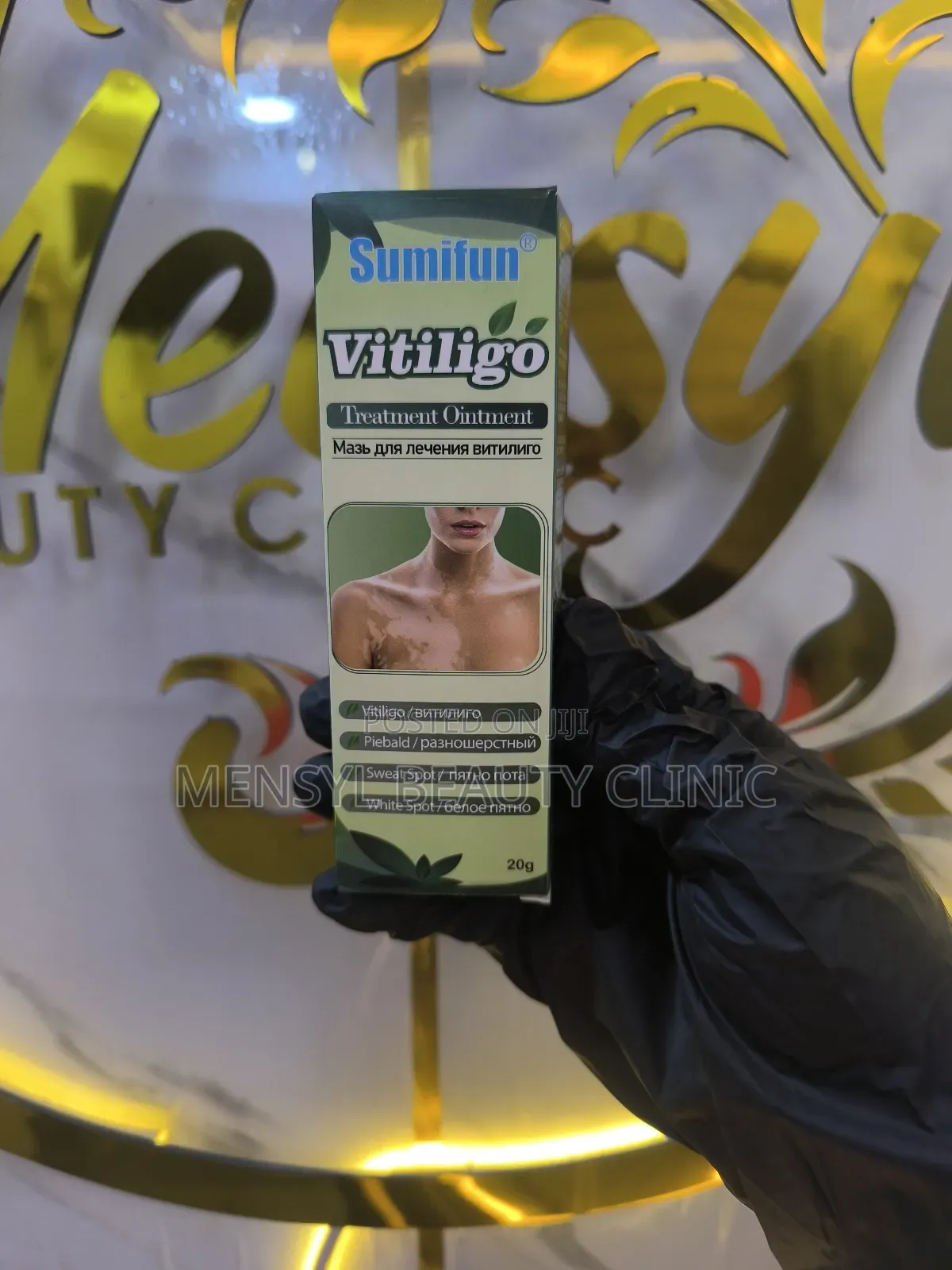 Vitiligo Cream Reduces White Spots on Skin