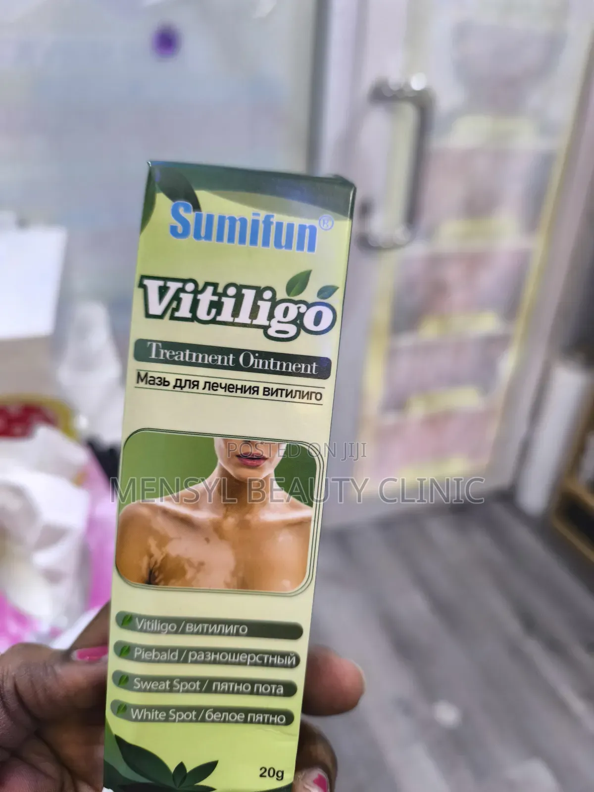 Vitiligo Cream Reduces White Spots on Skin