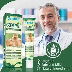 Vitiligo Cream Reduces White Spots on Skin