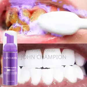 Teeth Whitening