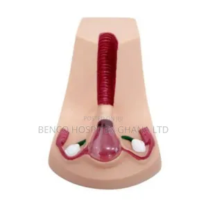 Contraceptive Device Model