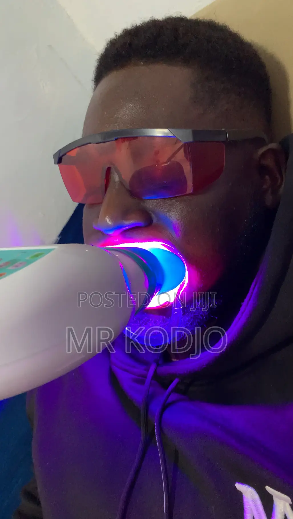 Teeth Whitening Service