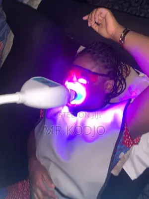 Teeth Whitening Service