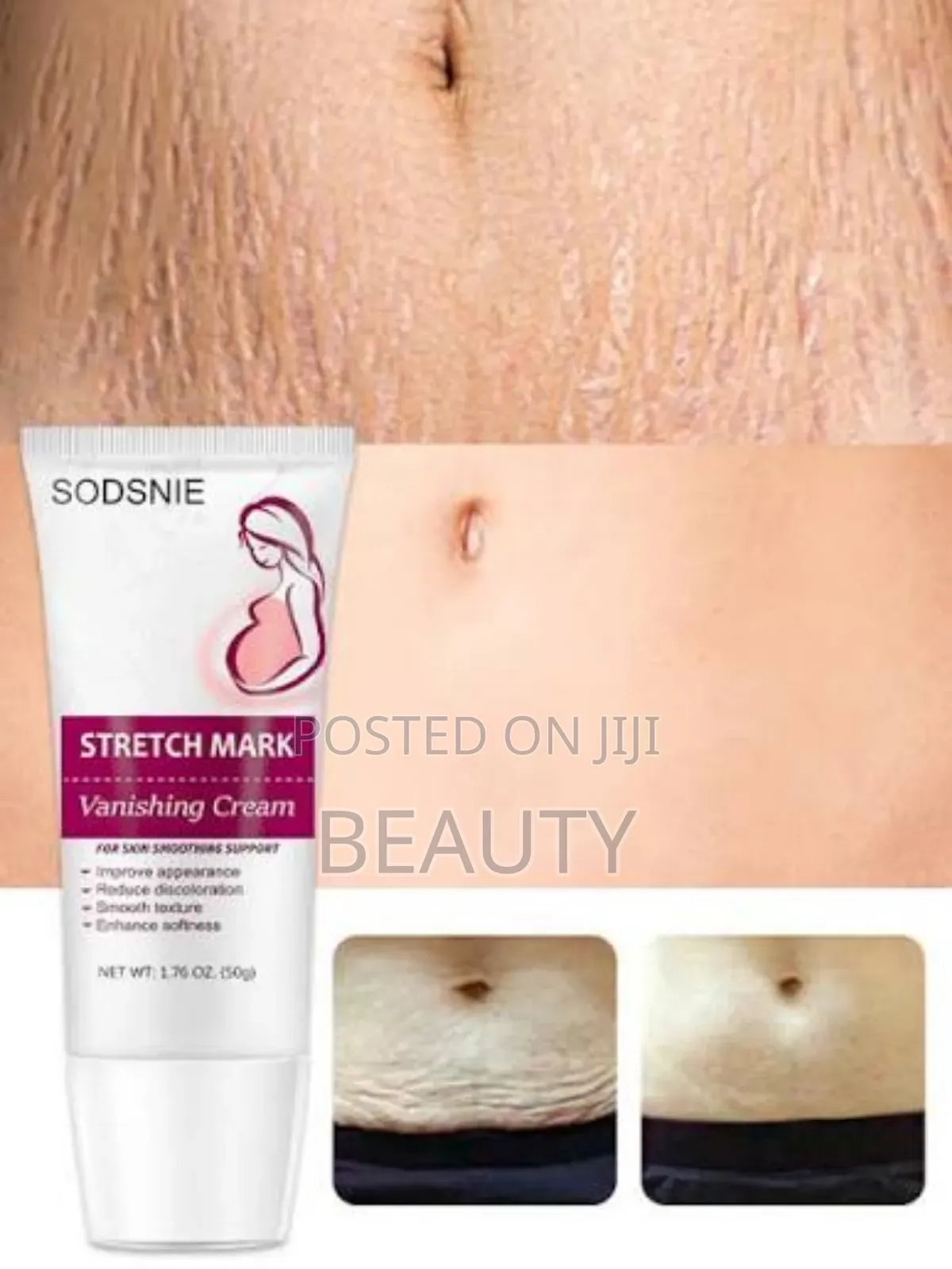Stretch Mark Product