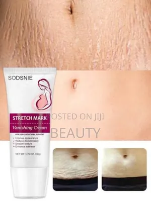 Stretch Mark Product