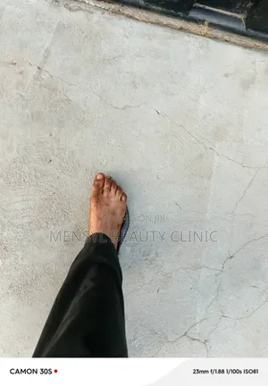 Laser Scar, Hair Removal, and Pigmentation Removal