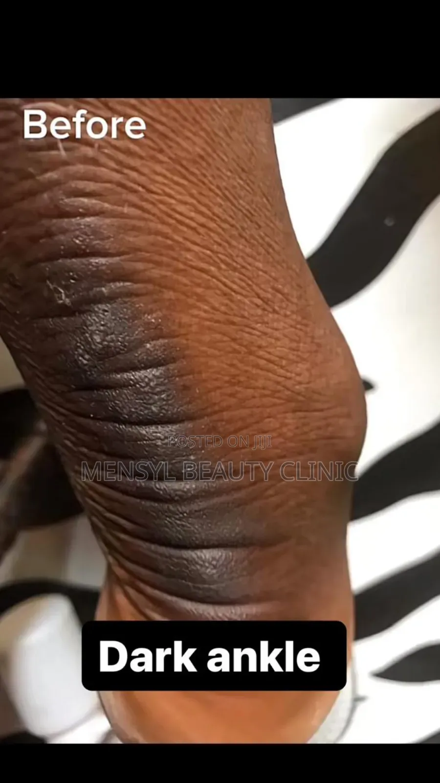 Laser Scar, Hair Removal, and Pigmentation Removal