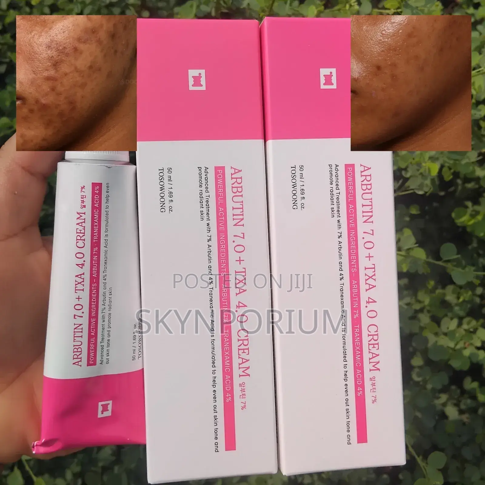 Original Tosowoong Arbutin 7.0 + Txa 4.0 Cream
