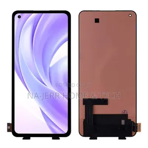 Xiaomi Mi 6 to 14 Screen, All Sorts of Series