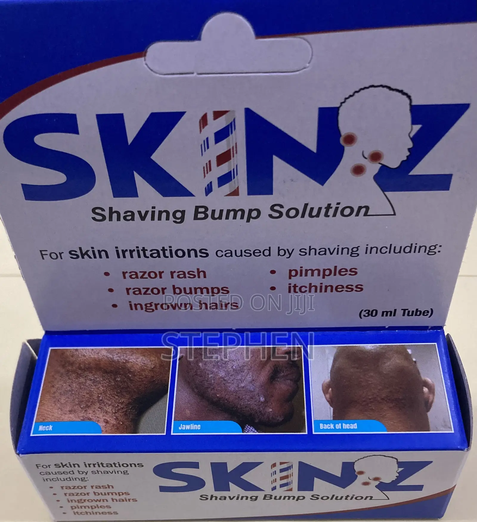 Skinz Solution for Shaving Bumps