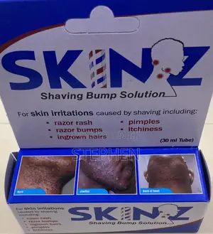 Skinz Solution for Shaving Bumps