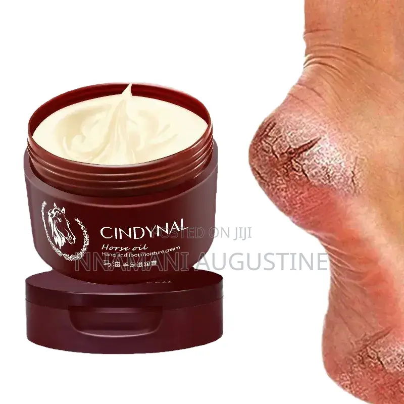 Foot Peel Remover Cream
