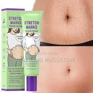Stretch Marks Removal Cream