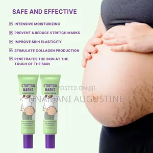Stretch Marks Removal Cream
