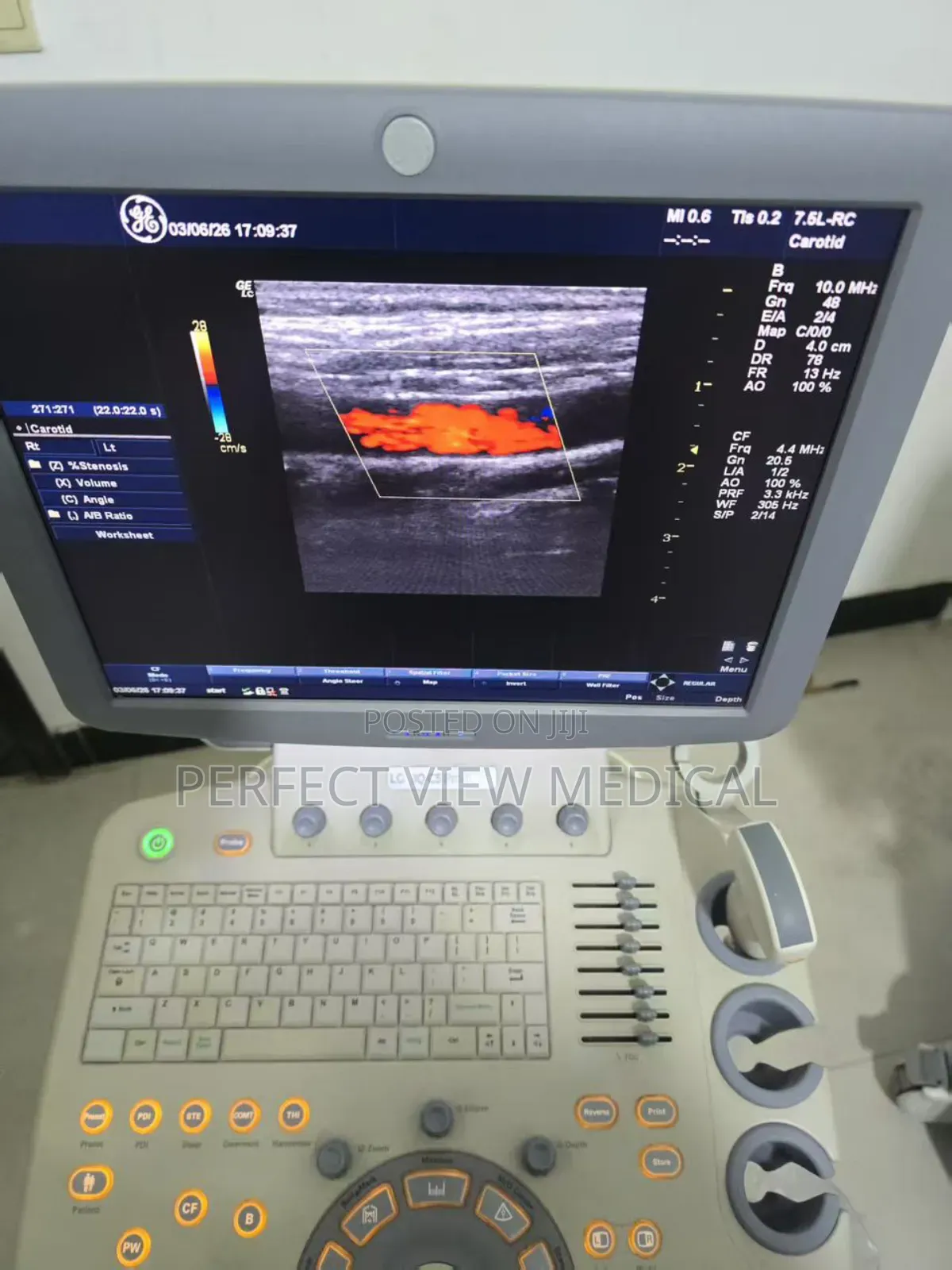 Slightly Foreign Used Ge C5 Premium 3d Color Doppler Scan Machine
