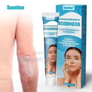 Psoriasis Cream Dermatitis Ointment