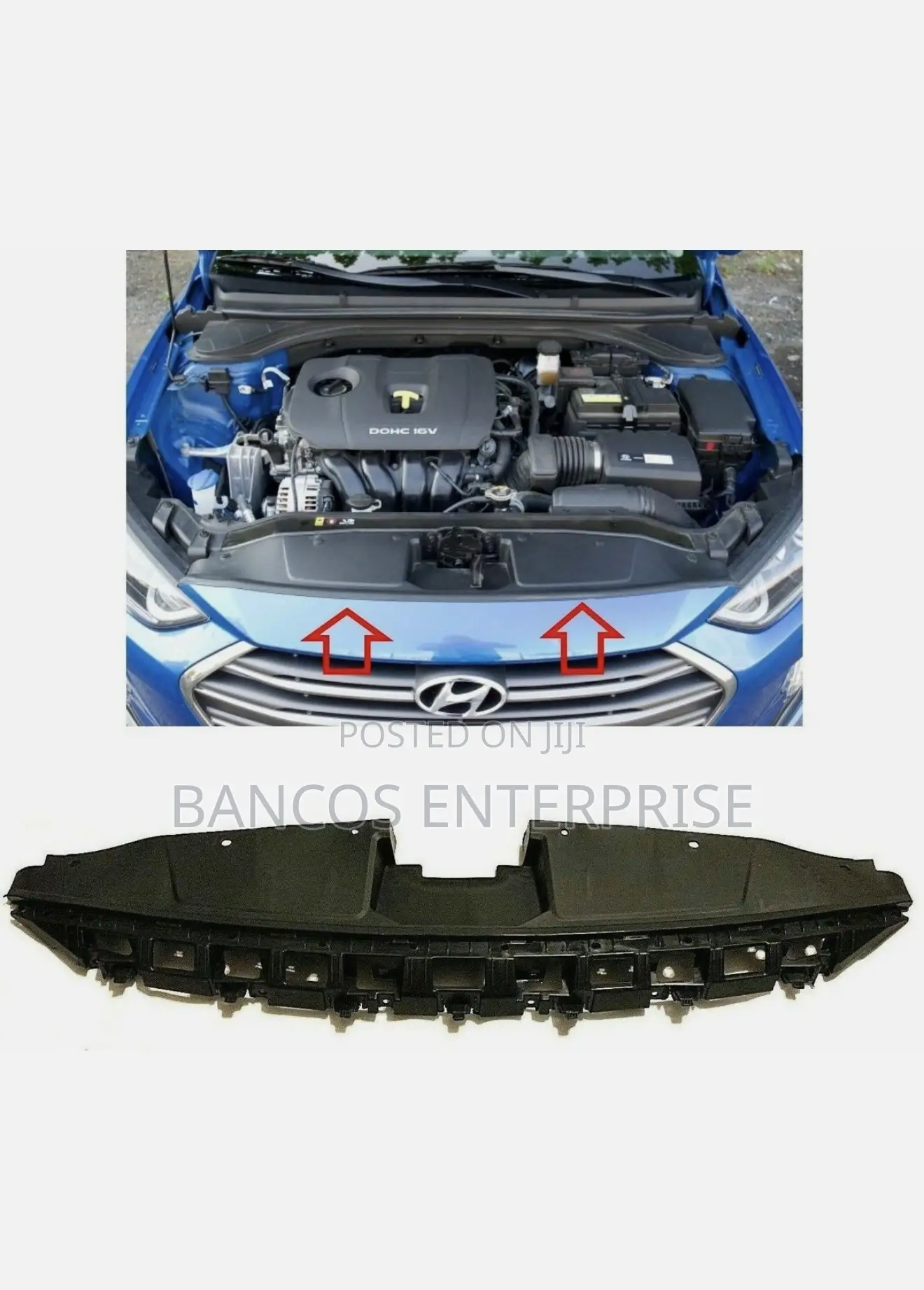 Hyundai Elantra 2017-2018 Grille, Cover, and Bumper Lip