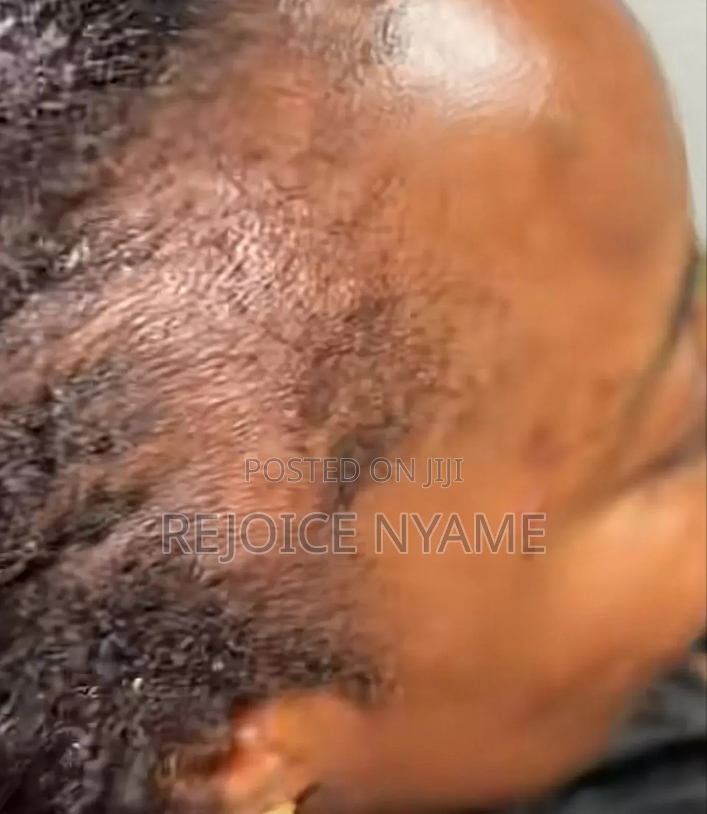 Mandy's Hair Grow Product