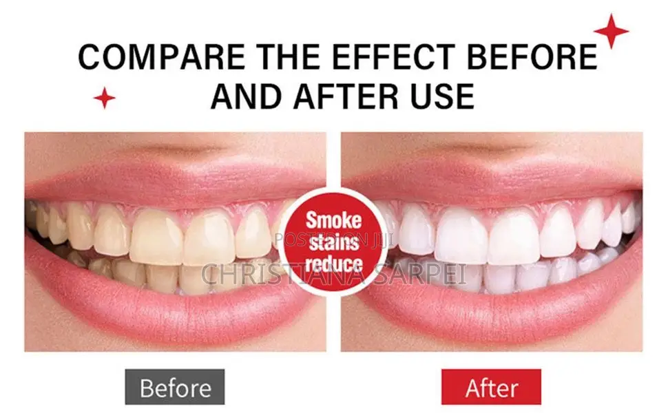Toothpaste