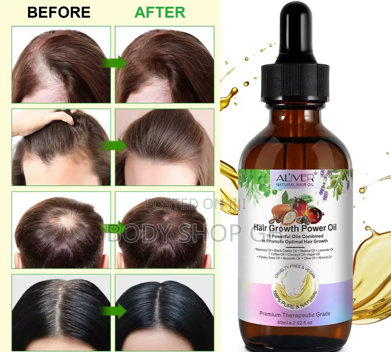 Aliver Hair Growth Power Oil- Castor + Rosemary + Batana + Coconut Oil