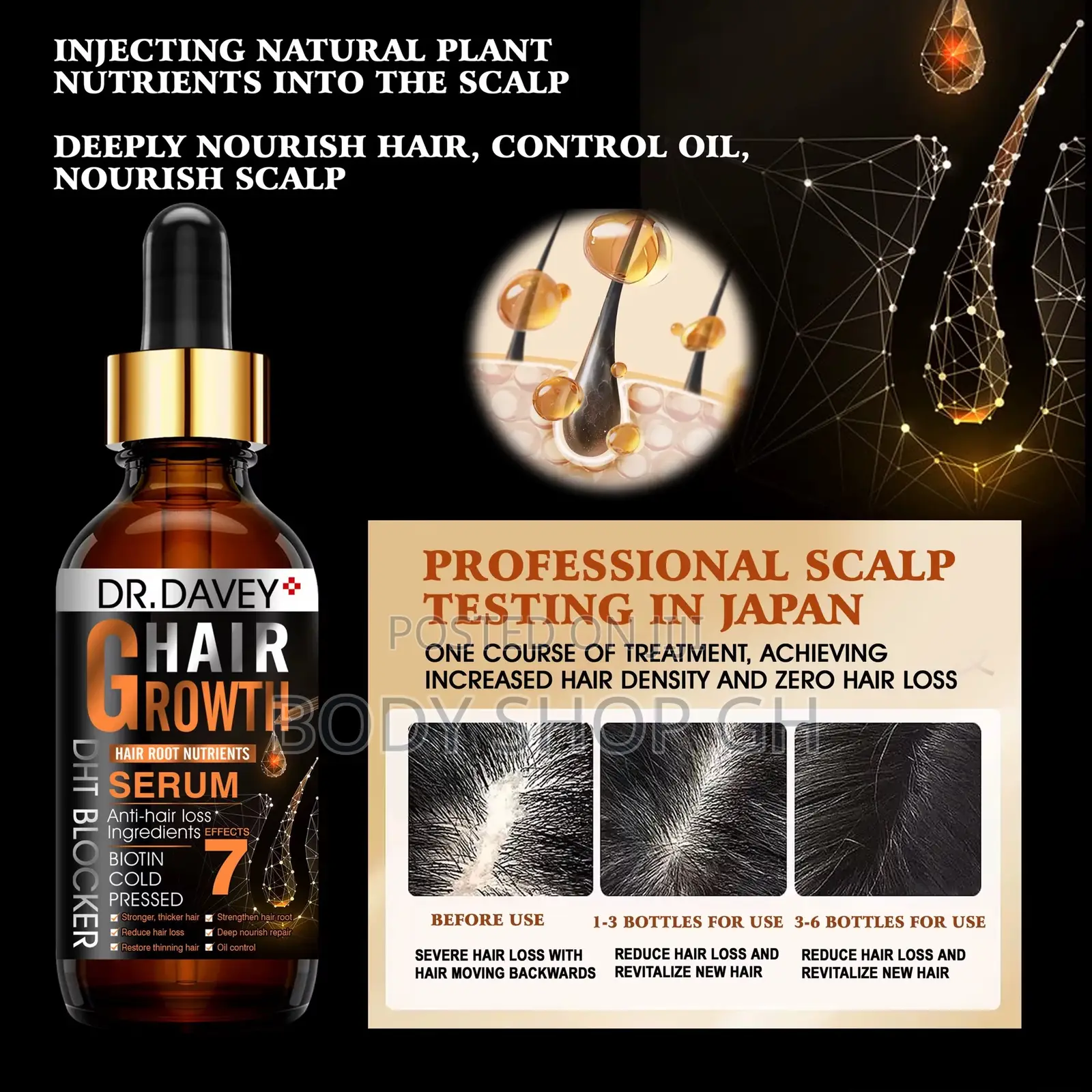 DHT Blocker Oil - Stops Hair Loss, Strengthens and Regrow Hair