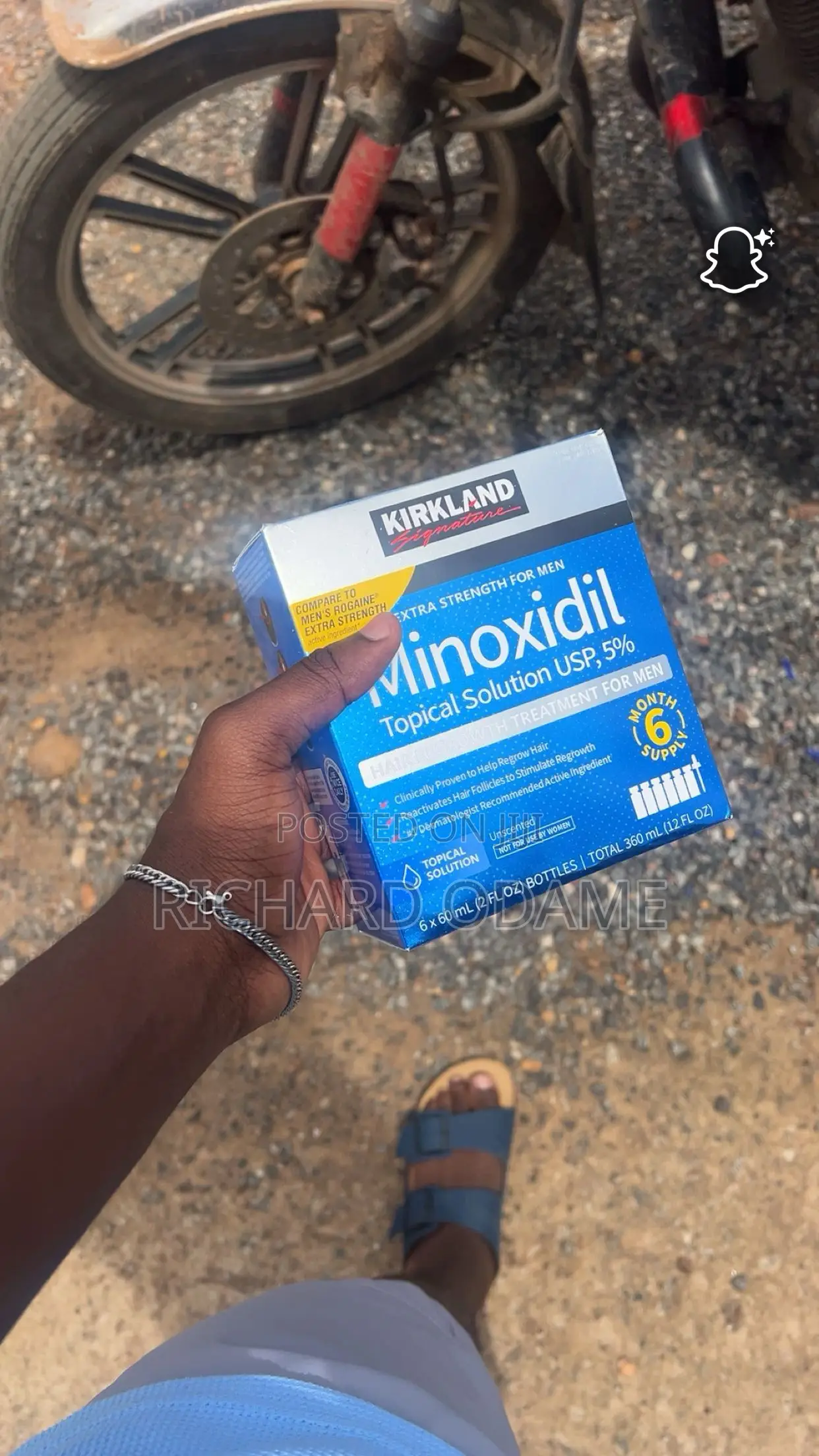 Kirkland Minoxidil (Original Costco)