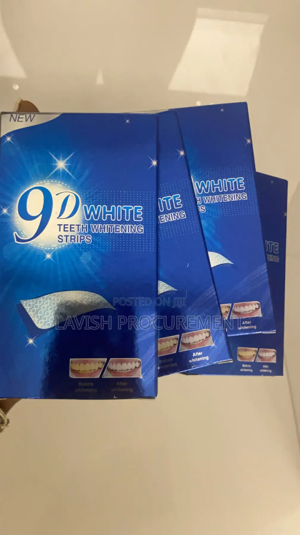 Teeth Whitening Strips