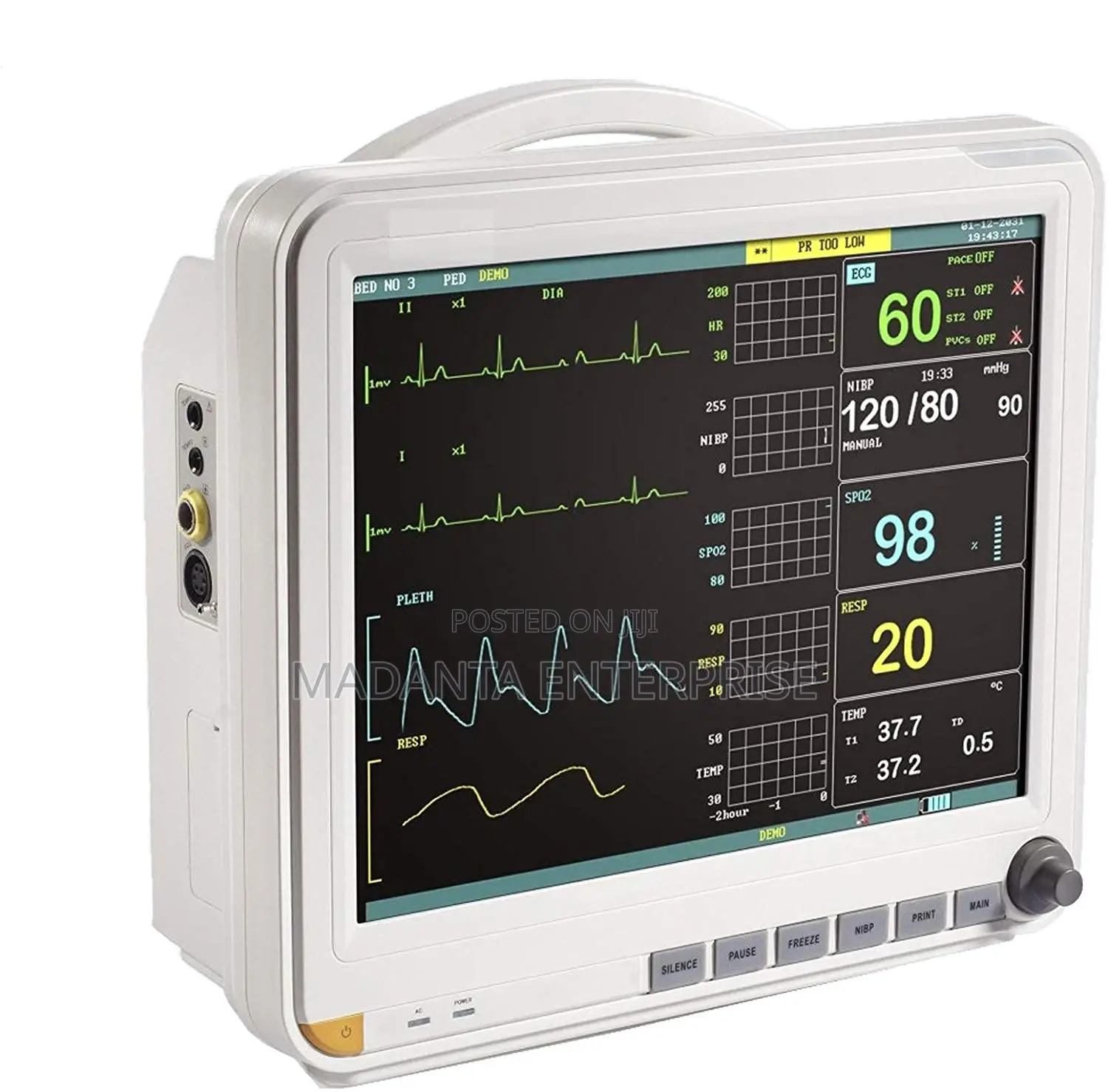 Patient Monitor