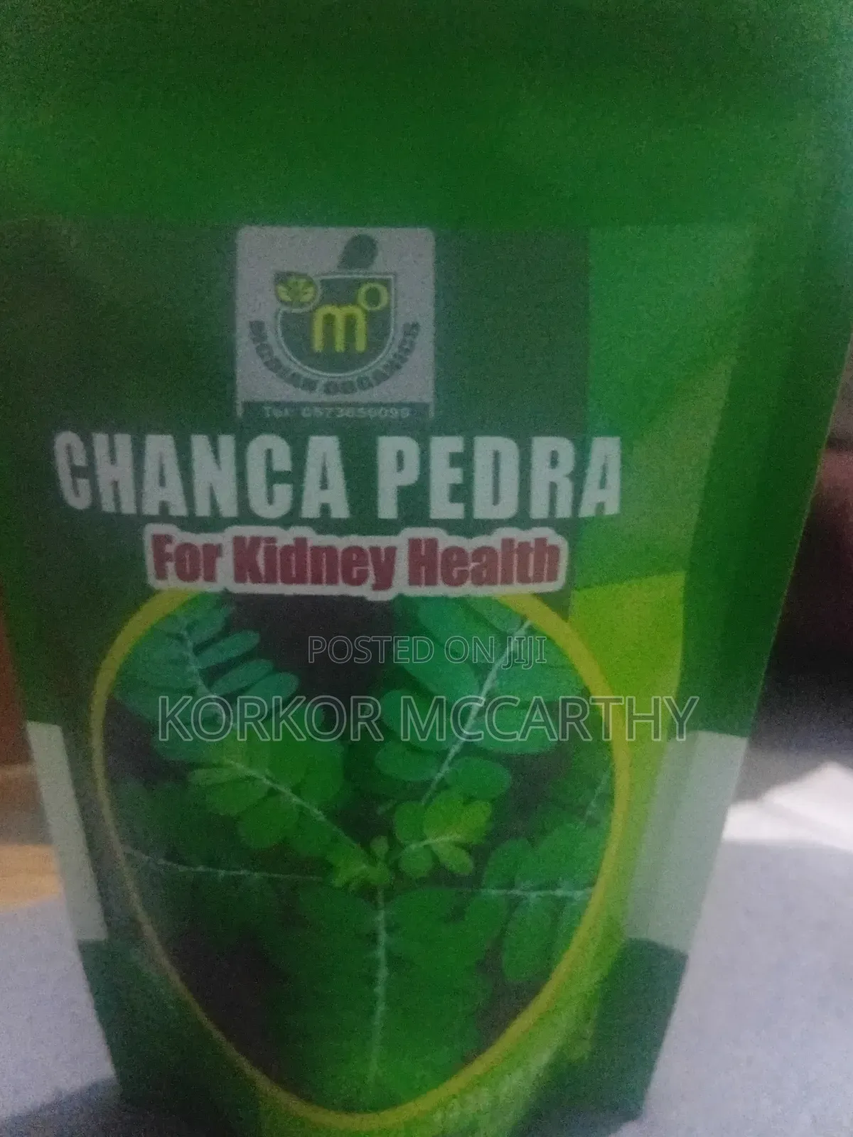 Chianca Pedra( Treating Kidney Stone