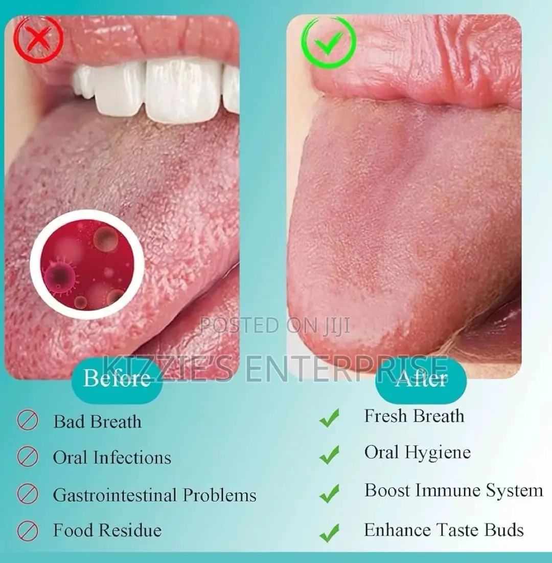 3pcs Tongue Scraper