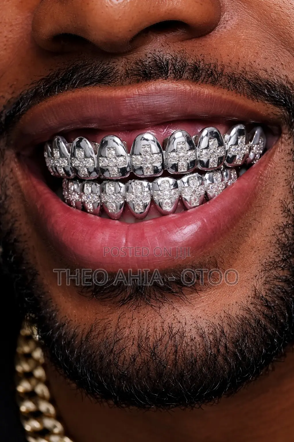 Iced Zirconia Teeth Grillz