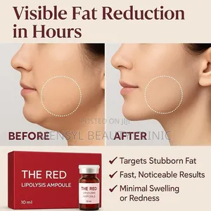 Red Lipolysis Injection for Stubborn Fat on Face, Tummy Inner Thighs