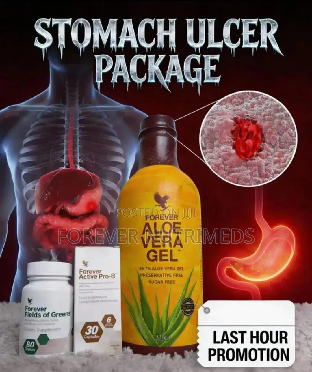Stomach Ulcer Supplements