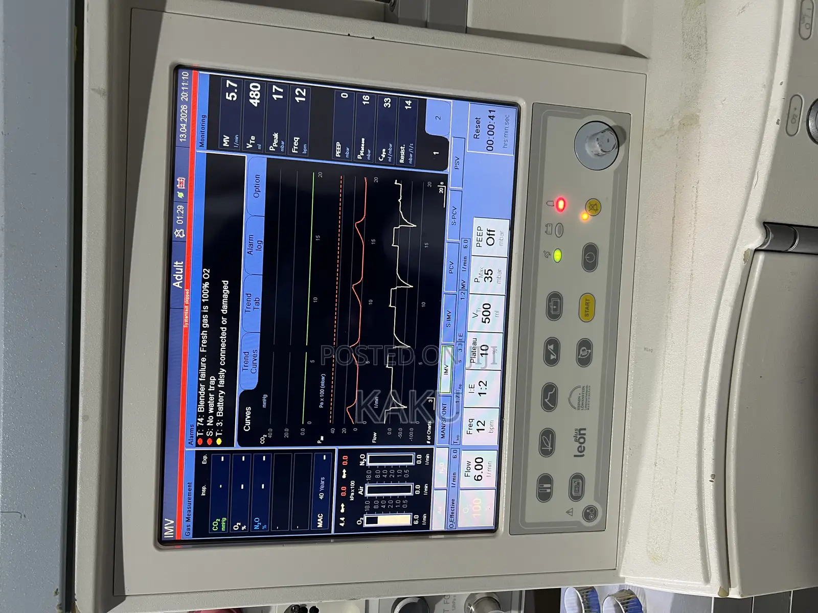Anesthesia Machine
