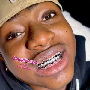Teeth Braces