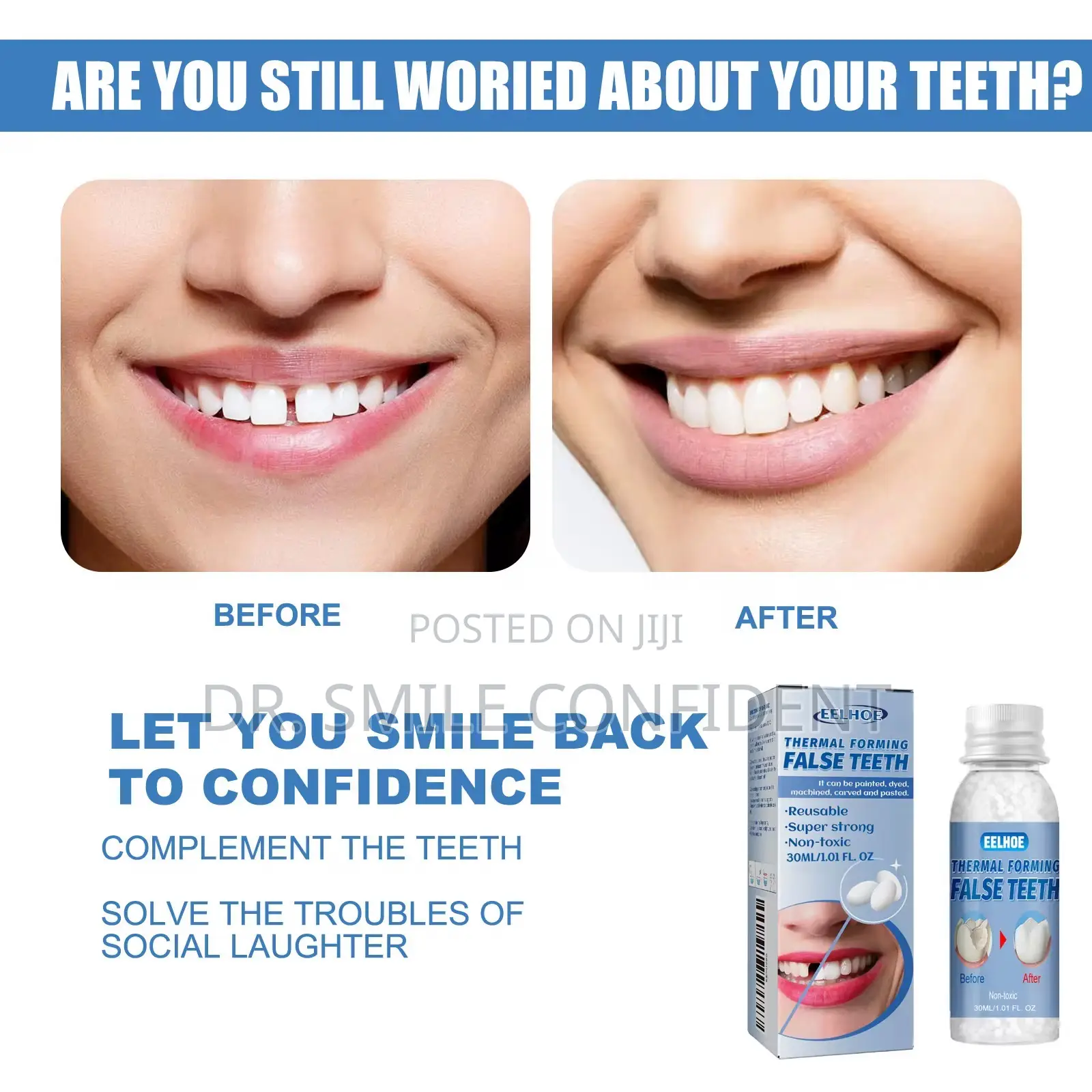 Moldable False Teeth