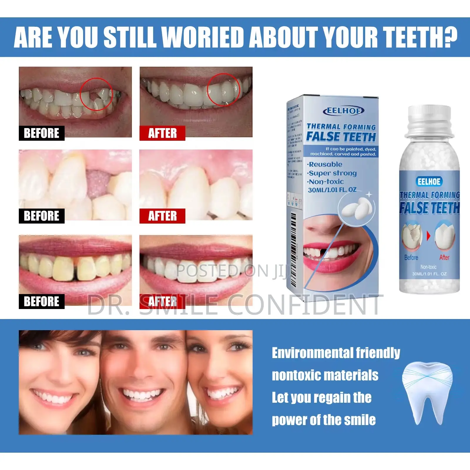 Moldable False Teeth