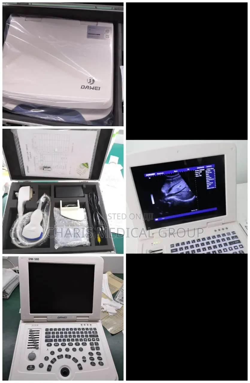 Dw 580 Portable Ultrasound Machine