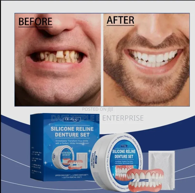 Silicone Reline Denture Set