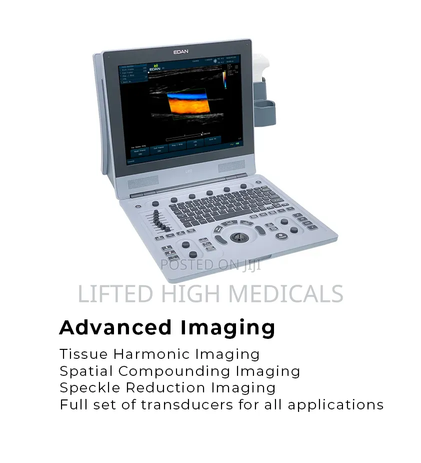 Edan U60 Color Doppler Ultrasound Machine