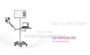 Edan C6hd Digital Video Colposcope for Gynecology