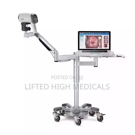 Edan C6hd Digital Video Colposcope for Gynecology