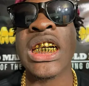 Luxury Gold Grillz Teeth Caps – Hip Hop Fashion Dental Grill Set