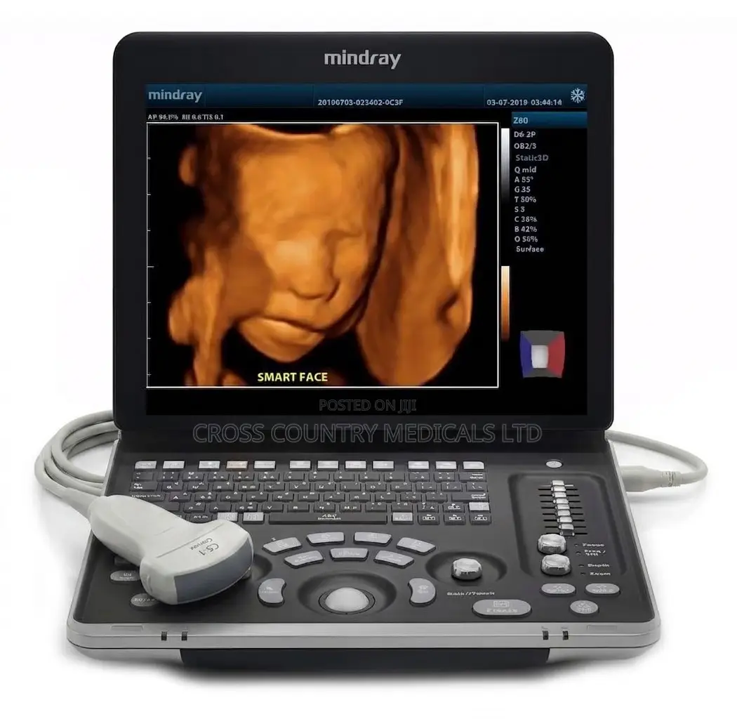 Ultrasound Scan Machine(Mindray)