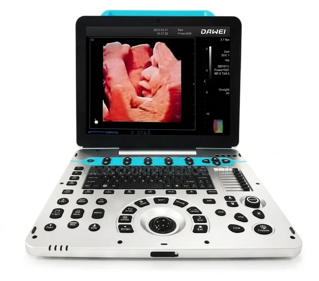 Ultrasound Scan Machine (Dawe)
