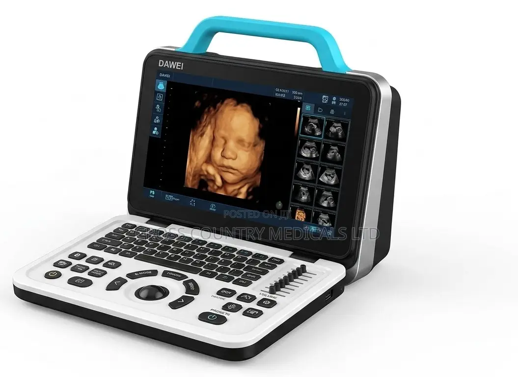 Ultrasound Scan Machine (Dawe)