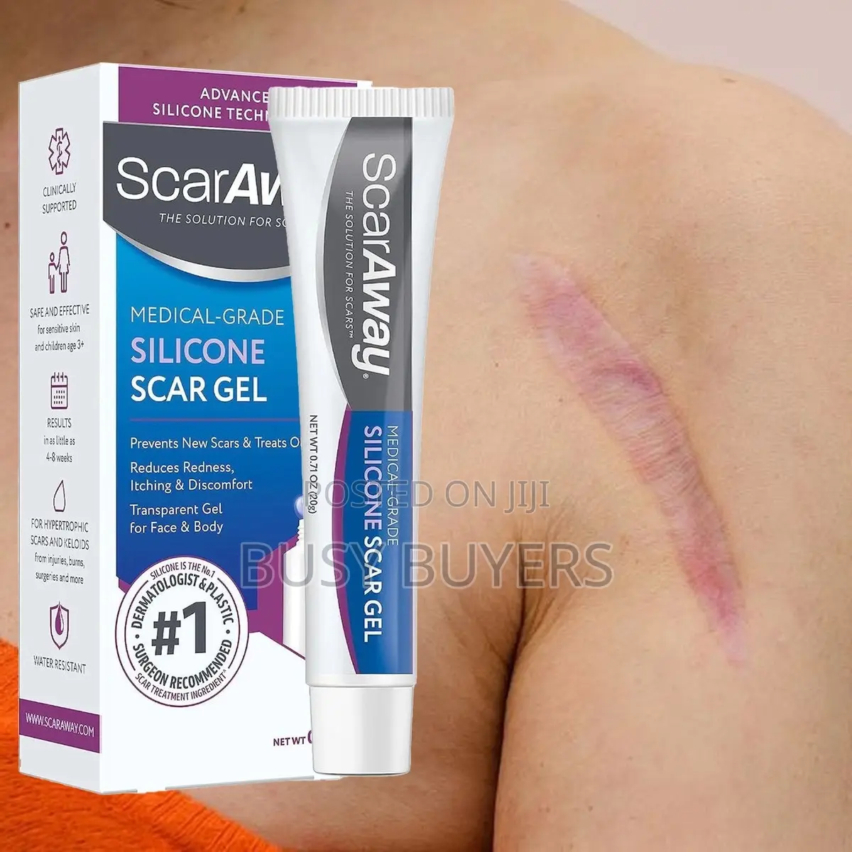Scaraway The Solution For Scars(Medical-grade Silicone Scar Gel )